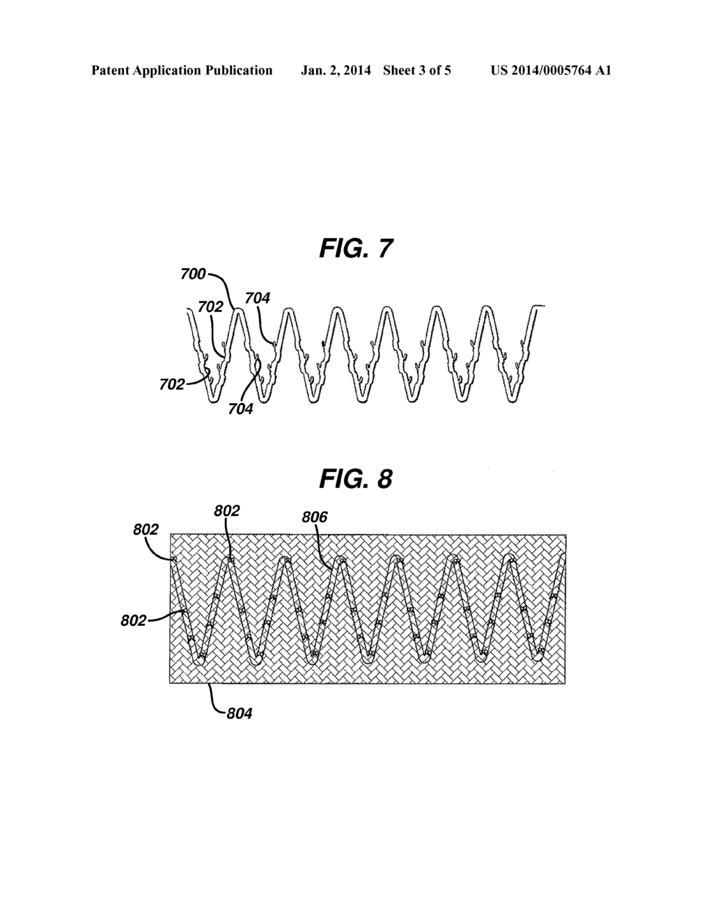 SEALING MECHANISM FOR EXPANDABLE VASCULAR DEVICE - diagram, schematic, and image 04