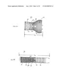 Transcatheter Heart Valve Delivery System With Reduced Area Moment of     Inertia diagram and image