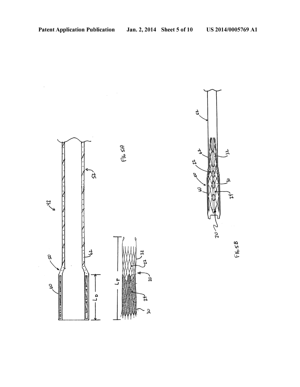 Transcatheter Heart Valve Delivery System With Reduced Area Moment of     Inertia - diagram, schematic, and image 06