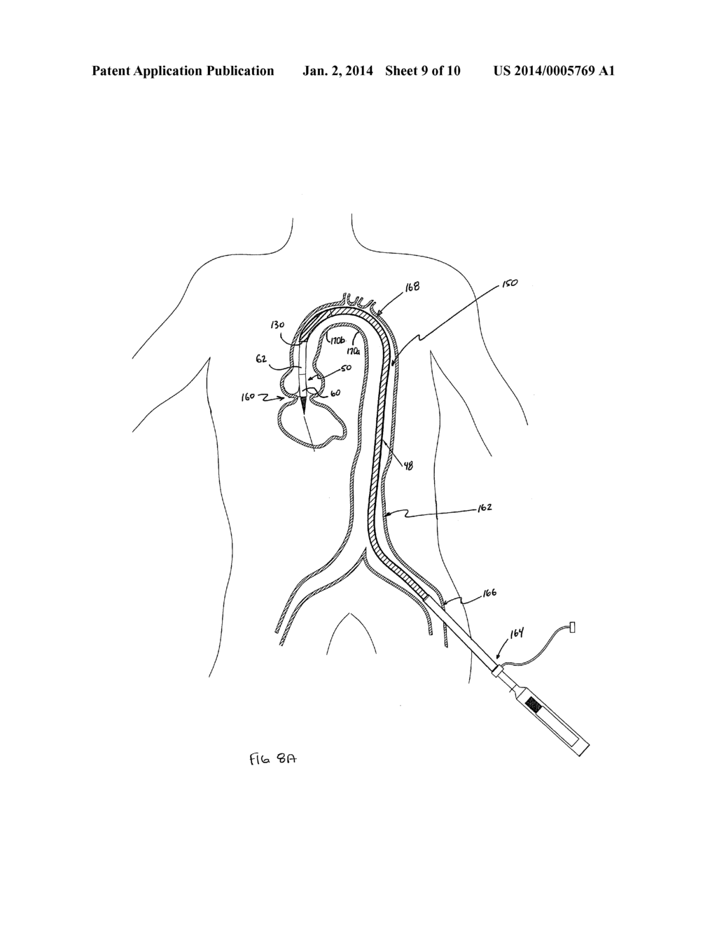 Transcatheter Heart Valve Delivery System With Reduced Area Moment of     Inertia - diagram, schematic, and image 10