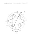 Intraocular Lens with Accommodation diagram and image