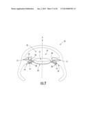 Intraocular Lens with Accommodation diagram and image