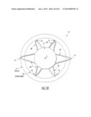 Intraocular Lens with Accommodation diagram and image