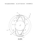 Intraocular Lens with Accommodation diagram and image