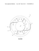 Intraocular Lens with Accommodation diagram and image