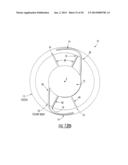 Intraocular Lens with Accommodation diagram and image