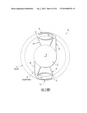 Intraocular Lens with Accommodation diagram and image