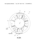 Intraocular Lens with Accommodation diagram and image