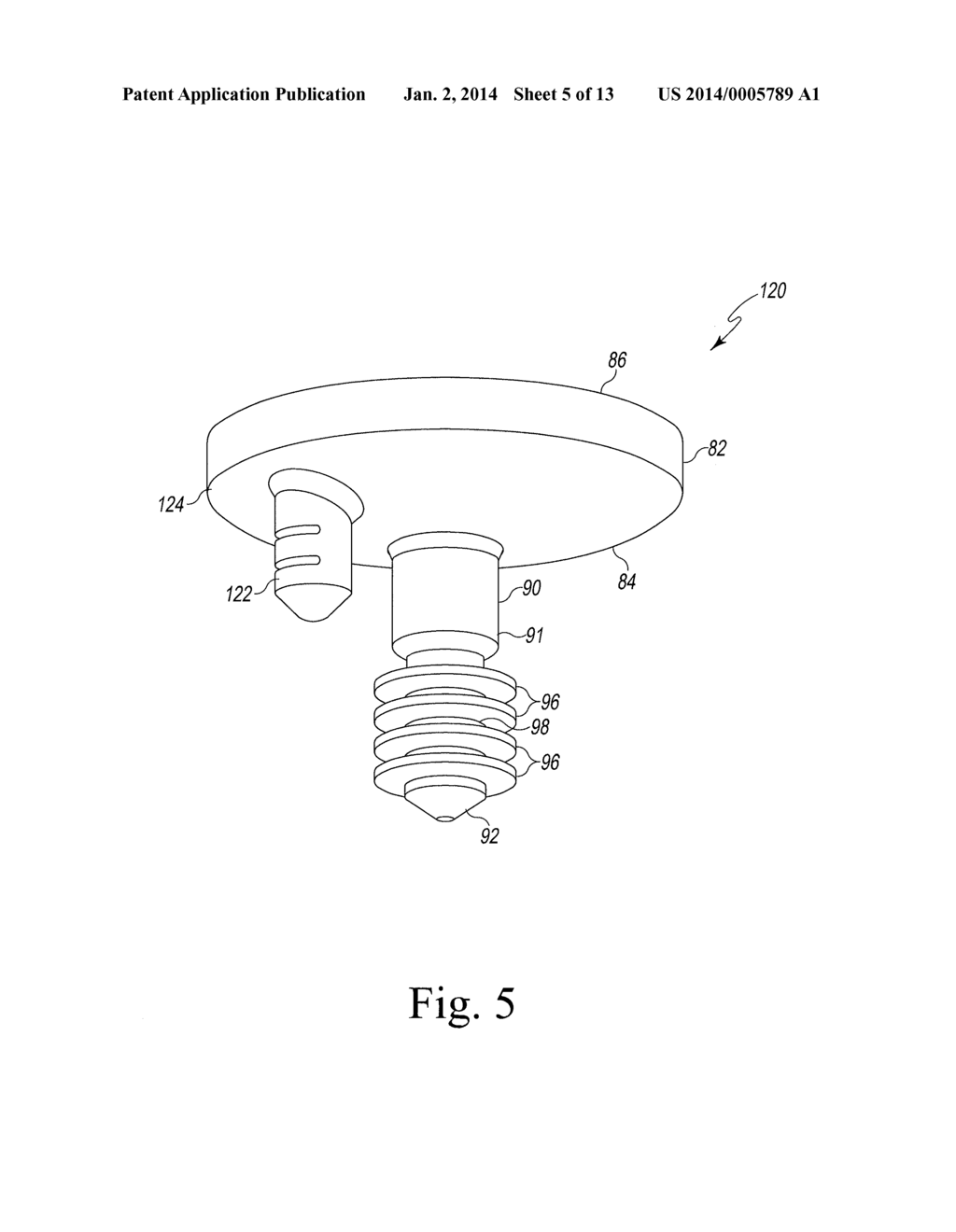 Modified Glenoid Components and Methods of Installing Same - diagram, schematic, and image 06