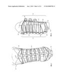 ADJUSTABLE PROSTHETIC LIMB SYSTEM diagram and image