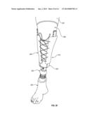 ADJUSTABLE PROSTHETIC LIMB SYSTEM diagram and image