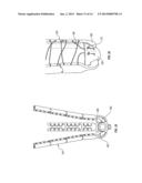 ADJUSTABLE PROSTHETIC LIMB SYSTEM diagram and image