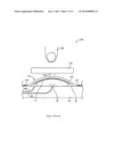 BULK AMORPHOUS ALLOY PRESSURE SENSOR diagram and image