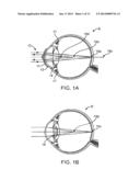 HIGH EFFICIENCY OPTIC diagram and image