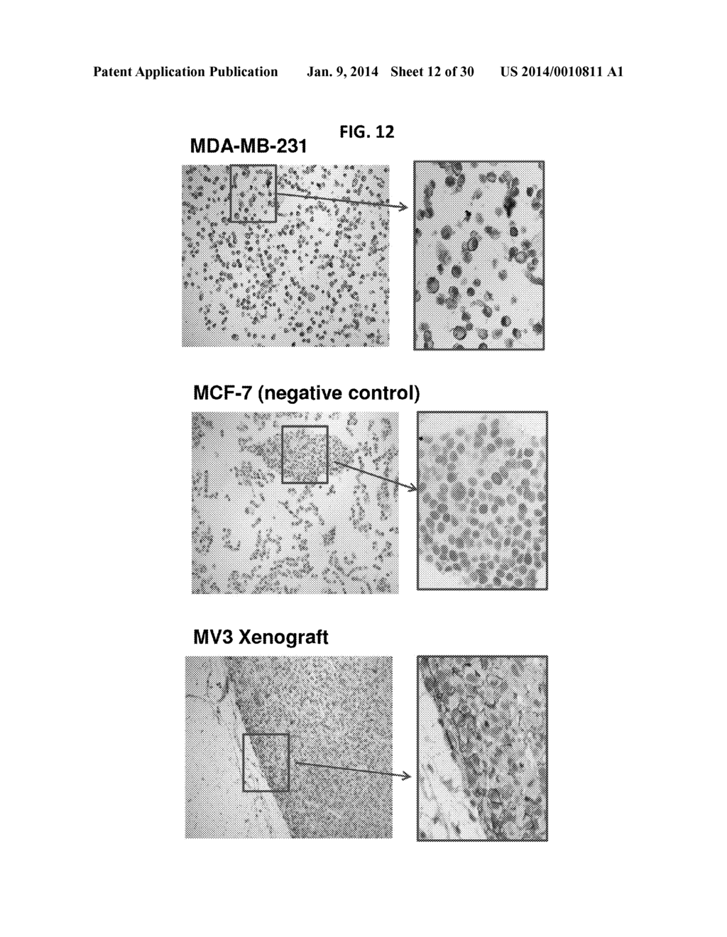 ANTIBODIES TO ENDOPLASMIN AND THEIR USE - diagram, schematic, and image 13