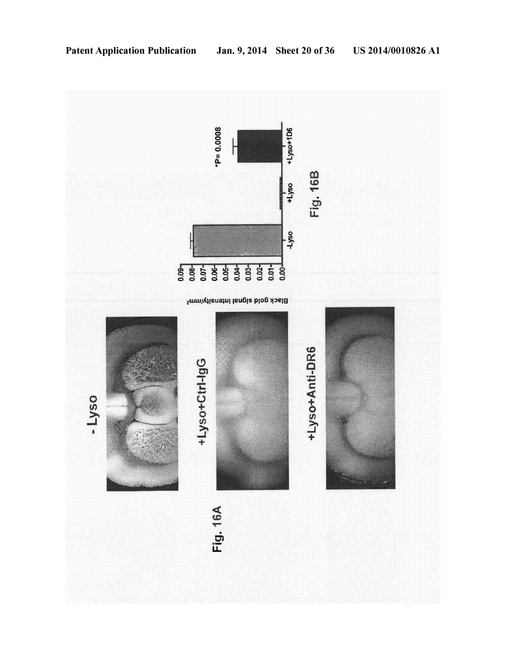 Use of DR6 and p75 Antagonists to Promote Survival of Cells of the Nervous     System - diagram, schematic, and image 21