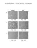 METHODS OF REPROGRAMMING RENAL CELLS diagram and image