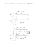 TERMINAL WELD TAB HAVING A WIRE SQUEEZE LIMITER diagram and image