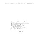 TERMINAL WELD TAB HAVING A WIRE SQUEEZE LIMITER diagram and image