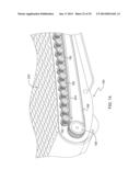 LEG-POWERED TREADMILL diagram and image