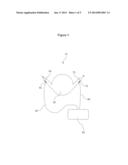 PREVENTION OF AORTIC VALVE FUSION diagram and image