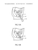 APPARATUS, METHOD AND SYSTEM FOR DETERMINING A PHYSIOLOGICAL CONDITION     WITHIN A MAMMAL diagram and image