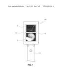 OPTICAL TOMOGRAPHIC IMAGING OTOSCOPE WITH INTEGRATED DISPLAY AND DIAGNOSIS diagram and image