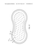 METHOD AND APPARATUS TO MEASURE BIOELECTRIC IMPEDANCE OF PATIENT TISSUE diagram and image