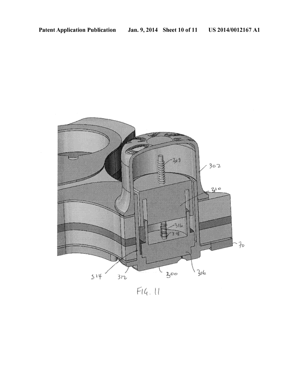 WEARABLE THORAX PERCUSSION DEVICE - diagram, schematic, and image 11