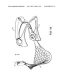 ADJUSTABLE CERVICAL COLLAR diagram and image