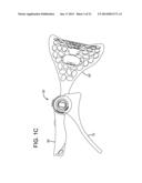 ADJUSTABLE CERVICAL COLLAR diagram and image