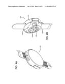 ADJUSTABLE CERVICAL COLLAR diagram and image