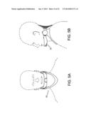 ADJUSTABLE CERVICAL COLLAR diagram and image