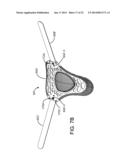 ADJUSTABLE CERVICAL COLLAR diagram and image