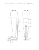 DEVICE FOR MITIGATING PLANTAR FASCIITIS diagram and image