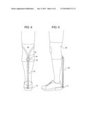 DEVICE FOR MITIGATING PLANTAR FASCIITIS diagram and image