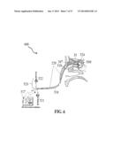 ALZHEIMER S DISEASE TREATMENT WITH MULTIPLE THERAPEUTIC AGENTS DELIVERED     TO THE OLFACTORY REGION THROUGH A SPECIAL DELIVERY CATHETER AND     IONTOPHORESIS diagram and image