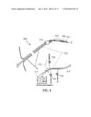 ALZHEIMER S DISEASE TREATMENT WITH MULTIPLE THERAPEUTIC AGENTS DELIVERED     TO THE OLFACTORY REGION THROUGH A SPECIAL DELIVERY CATHETER AND     IONTOPHORESIS diagram and image