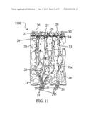 ALZHEIMER S DISEASE TREATMENT WITH MULTIPLE THERAPEUTIC AGENTS DELIVERED     TO THE OLFACTORY REGION THROUGH A SPECIAL DELIVERY CATHETER AND     IONTOPHORESIS diagram and image