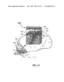 ALZHEIMER S DISEASE TREATMENT WITH MULTIPLE THERAPEUTIC AGENTS DELIVERED     TO THE OLFACTORY REGION THROUGH A SPECIAL DELIVERY CATHETER AND     IONTOPHORESIS diagram and image