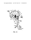 ALZHEIMER S DISEASE TREATMENT WITH MULTIPLE THERAPEUTIC AGENTS DELIVERED     TO THE OLFACTORY REGION THROUGH A SPECIAL DELIVERY CATHETER AND     IONTOPHORESIS diagram and image