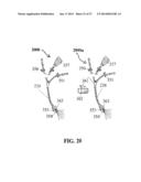 ALZHEIMER S DISEASE TREATMENT WITH MULTIPLE THERAPEUTIC AGENTS DELIVERED     TO THE OLFACTORY REGION THROUGH A SPECIAL DELIVERY CATHETER AND     IONTOPHORESIS diagram and image