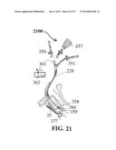 ALZHEIMER S DISEASE TREATMENT WITH MULTIPLE THERAPEUTIC AGENTS DELIVERED     TO THE OLFACTORY REGION THROUGH A SPECIAL DELIVERY CATHETER AND     IONTOPHORESIS diagram and image