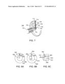 DEVICES FOR URETHRAL TREATMENT diagram and image