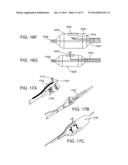 DEVICES FOR URETHRAL TREATMENT diagram and image