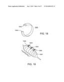 DEVICES FOR URETHRAL TREATMENT diagram and image