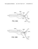 DEVICES FOR URETHRAL TREATMENT diagram and image