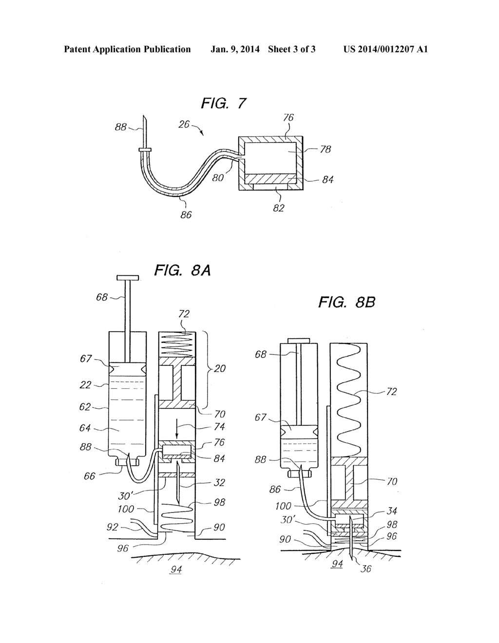 Injection System with Hidden Needles - diagram, schematic, and image 04