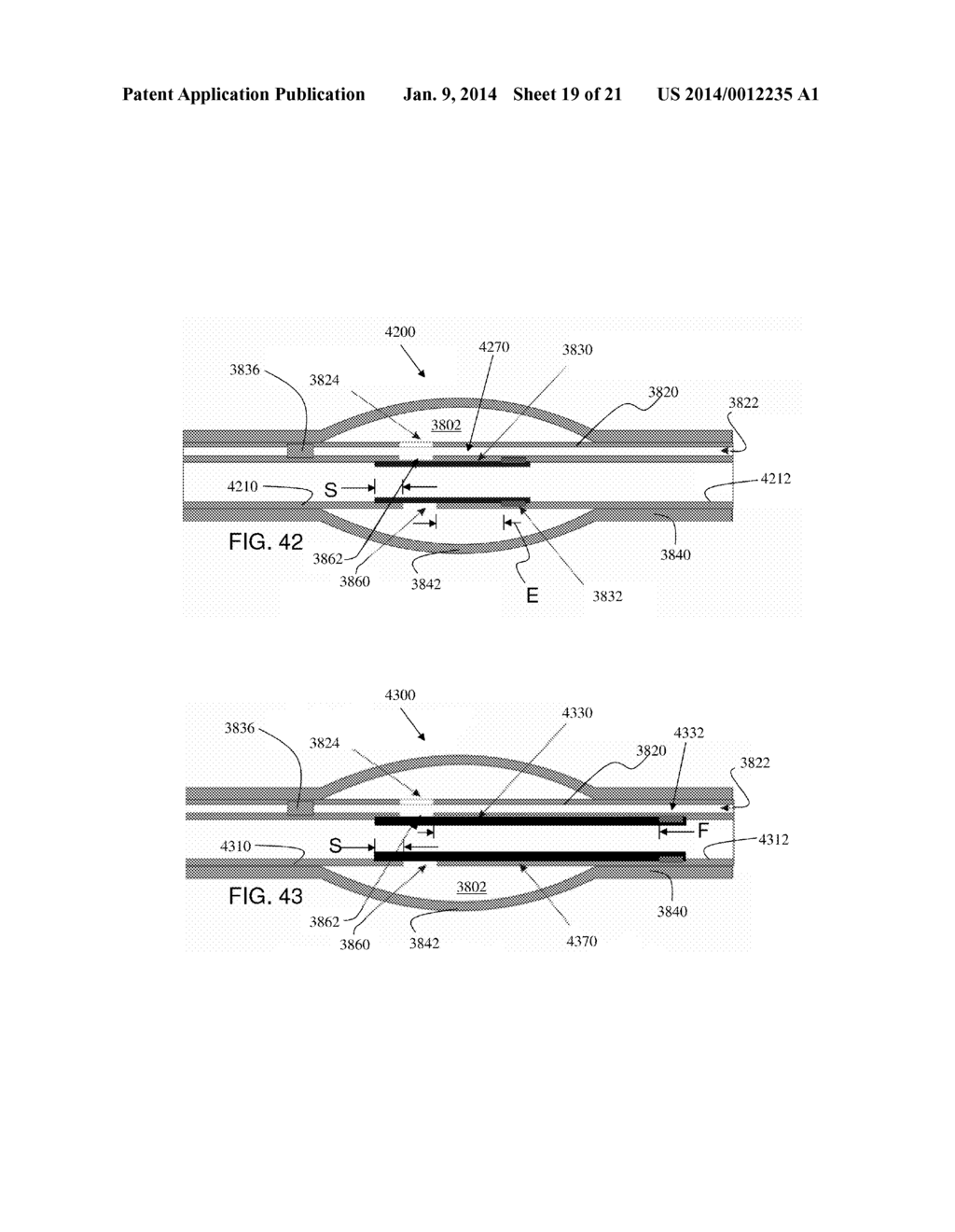 Stretch Valve Balloon Catheter and Methods for Producing and Using Same - diagram, schematic, and image 20