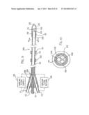 HYPERTHERMIA TREATMENT AND PROBE THEREFOR diagram and image